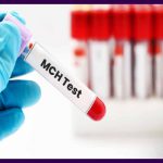 آزمایش MCH خون چیست ؟