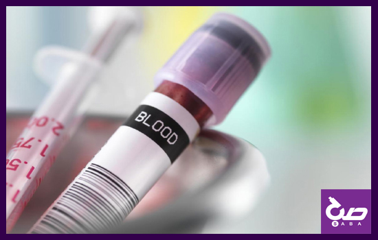 آزمایش شمارش کامل خون cbc