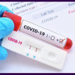پایش تیتر آنتی بادی متعاقب تزریق واکسن های کووید ۱۹ در ایران