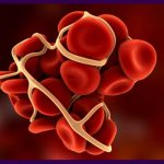 علائم انواع لخته خون در بدن