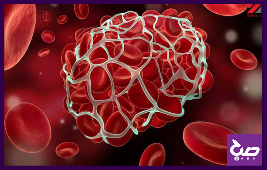 علائم انواع لخته خون در بدن 