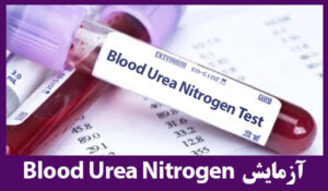 آزمایش نیتروژن اوره خون
