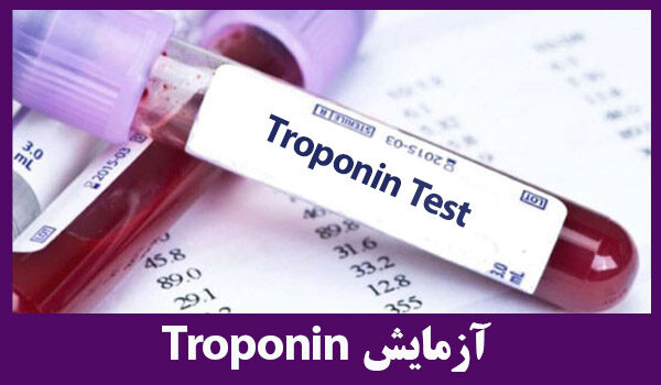 آزمایش تروپونین