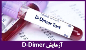 تست دی دایمر/d-dimer