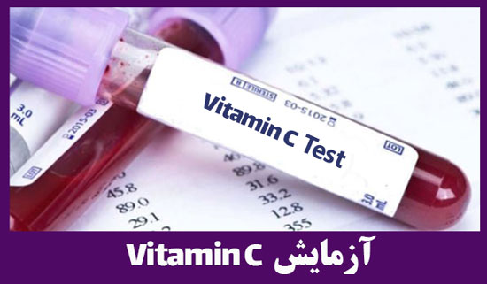 آزمایش ویتامین سی